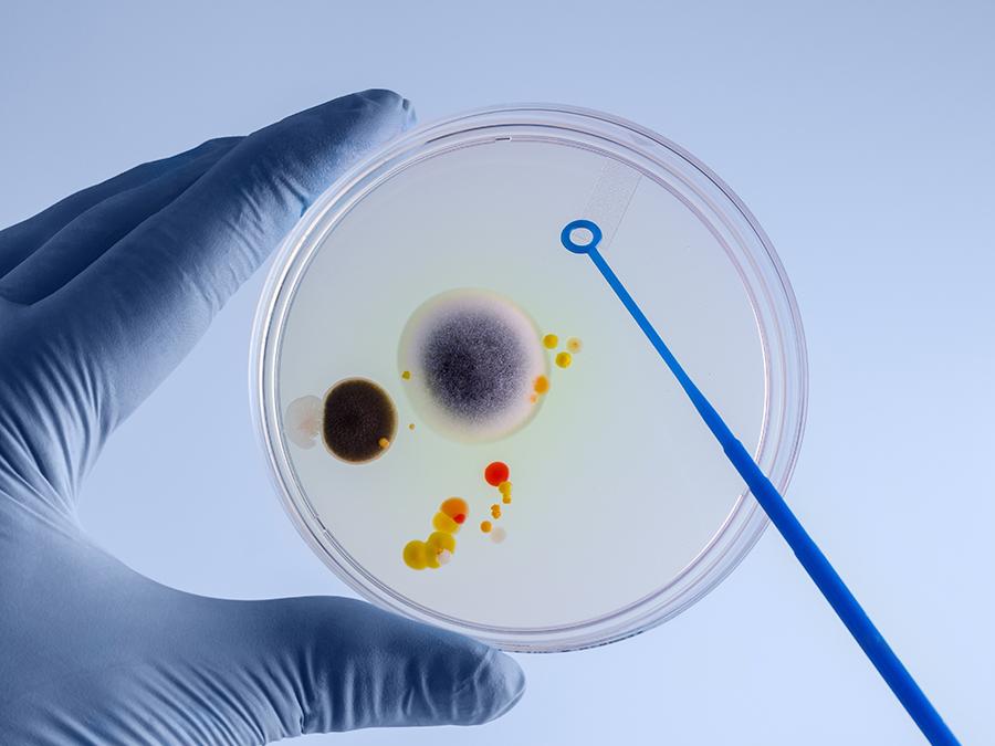 what are microbes and probiotics