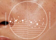 Close-up of skin texture with a circular graph overlay. The graph displays "Balanced Microbiome" on the left and "Unbalanced Microbiome" on the right, with various data points and lines illustrating differences.