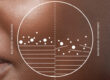 Close-up of a person's cheek with a diagram overlay. The diagram is split into two halves: the left labeled "Balanced Microbiome" with fewer dots and lines; the right labeled "Unbalanced Microbiome" with more dots and uneven lines.